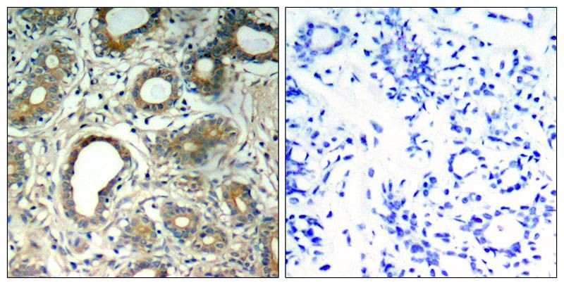 SHP-2 (Phospho-Tyr580) Rabbit Polyclonal Antibody, 100 ug