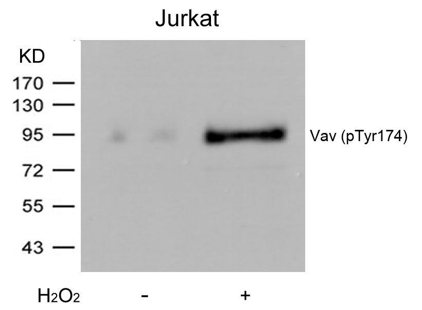 Vav (Phospho-Tyr174) Rabbit Polyclonal Antibody, 100 ug