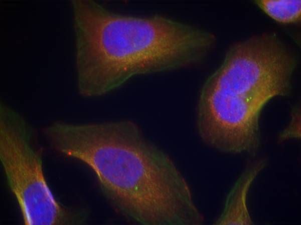 PKCθ (Phospho-Ser676) Rabbit Polyclonal Antibody, 100 ug
