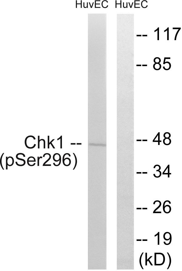 Chk1 (Phospho-Ser296) Rabbit Polyclonal Antibody, 100 ug