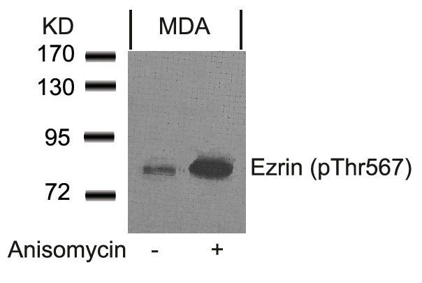 Ezrin (Phospho-Thr567) Rabbit Polyclonal Antibody, 100 ug