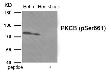 PKCB (Phospho-Ser661) Rabbit Polyclonal Antibody, 100 ug