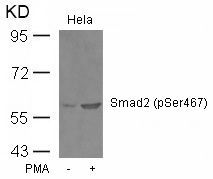 Smad2 (Phospho-Ser467) Rabbit Polyclonal Antibody, 100 ug