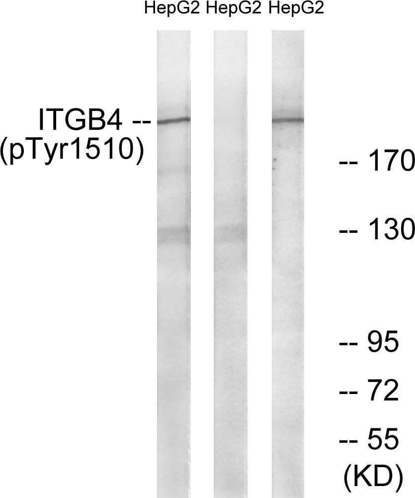ITGB4 (Phospho-Tyr1510) Rabbit Polyclonal Antibody, 100 ug