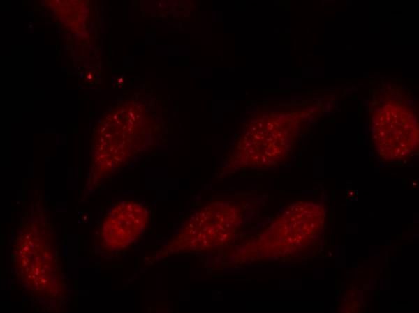 p53 (Phospho-Ser315) Rabbit Polyclonal Antibody, 100 ug