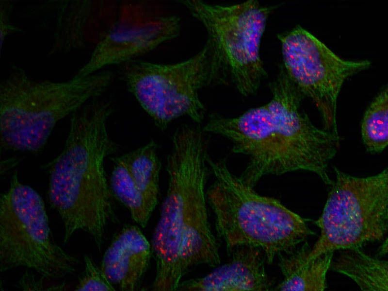 AKT1 (phospho-Thr450) Rabbit Polyclonal Antibody, 100 ug