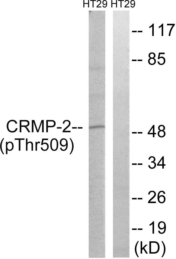 CRMP-2 (Phospho-Thr509) Rabbit Polyclonal Antibody, 100 ug