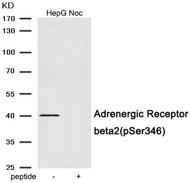 Adrenergic Receptor beta2 (Phospho-Ser346) Rabbit Polyclonal Antibody, 100 ug