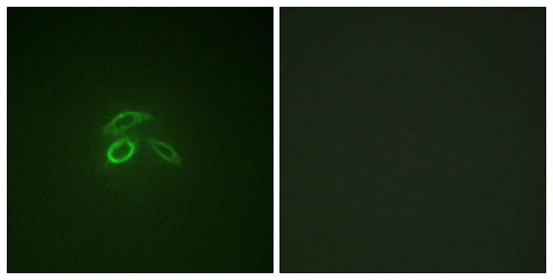 WEE1 (Phospho-Ser642) Rabbit Polyclonal Antibody, 100 ug