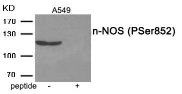 n-NOS (Phospho-Ser852) Rabbit Polyclonal Antibody, 100 ug n-NOS (Phospho-Ser852) Rabbit Polyclonal Antibody, 100 ug