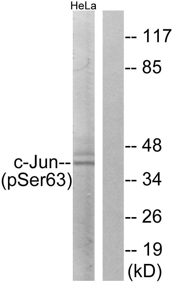 c-Jun (Phospho-Ser63) Rabbit Polyclonal Antibody, 100 ug