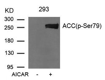 Acetyl-CoA Carboxylase (Phospho-Ser79) Rabbit Polyclonal Antibody, 100 ug