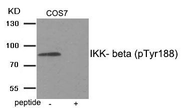 IKK- beta (Phospho-Tyr188) Rabbit Polyclonal Antibody, 100 ug