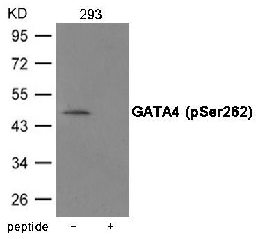 GATA4 (Phospho-Ser262) Rabbit Polyclonal Antibody, 100 ug