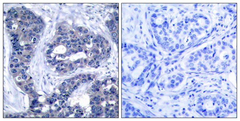 IRS-1 (Phospho-Ser639) Rabbit Polyclonal Antibody, 100 ug