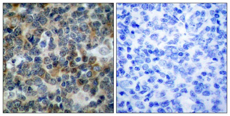 VASP (Phospho-Ser239) Rabbit Polyclonal Antibody, 100 ug
