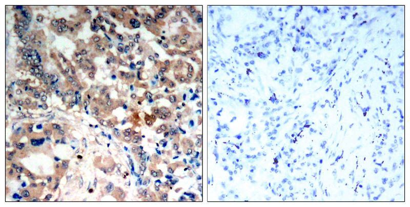 AMPKα1/AMPKα2(Phospho-Thr183/Thr172) Rabbit Polyclonal Antibody, 100 ug