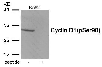 Cyclin D1 (Phospho-Ser90) Rabbit Polyclonal Antibody, 100 ug