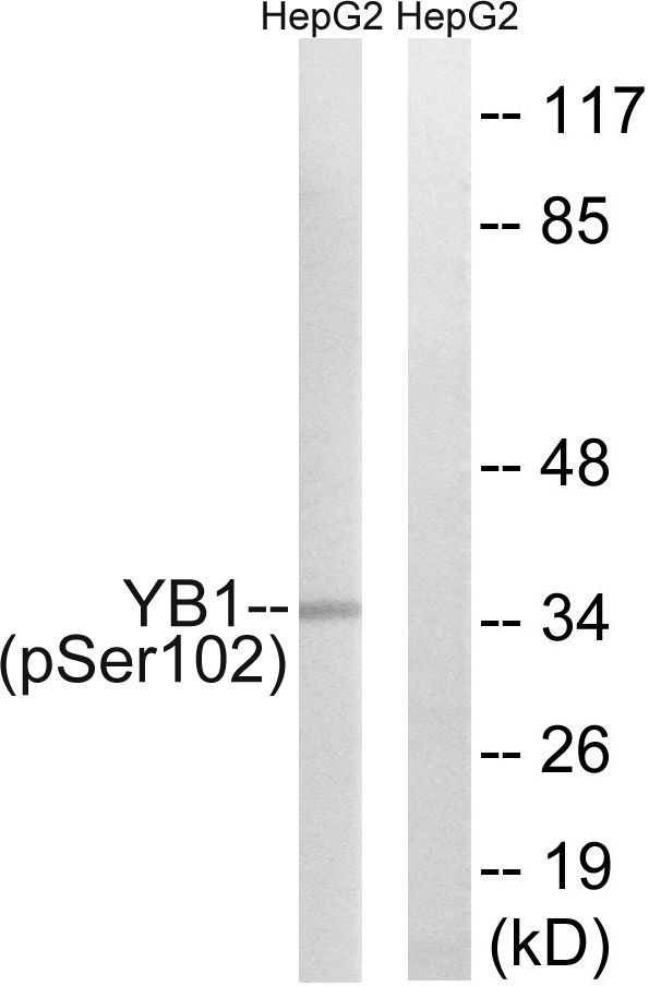 YB1 (Phospho-Ser102) Rabbit Polyclonal Antibody, 100 ug
