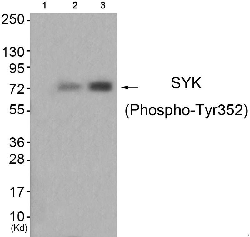 SYK (Phospho-Tyr352) Rabbit Polyclonal Antibody, 100 ug