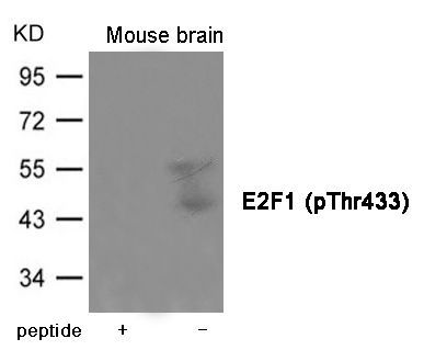 E2F1 (Phospho-Thr433) Rabbit Polyclonal Antibody, 100 ug