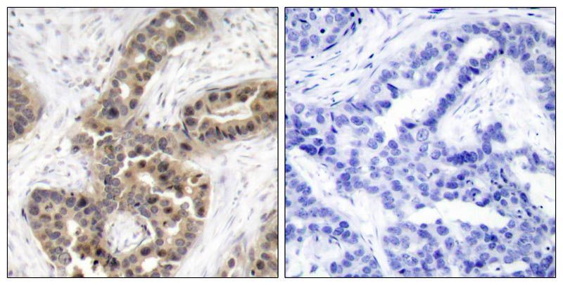 p21Cip1 (Phospho-Thr145) Rabbit Polyclonal Antibody, 100 ug