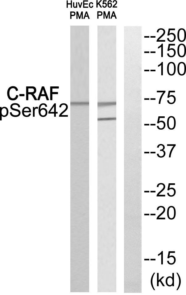 C-RAF (Phospho-Ser642) Rabbit Polyclonal Antibody, 100 ug