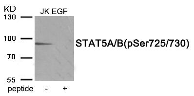 STAT5A/B (Phospho-Ser725/730) Rabbit Polyclonal Antibody, 100 ug