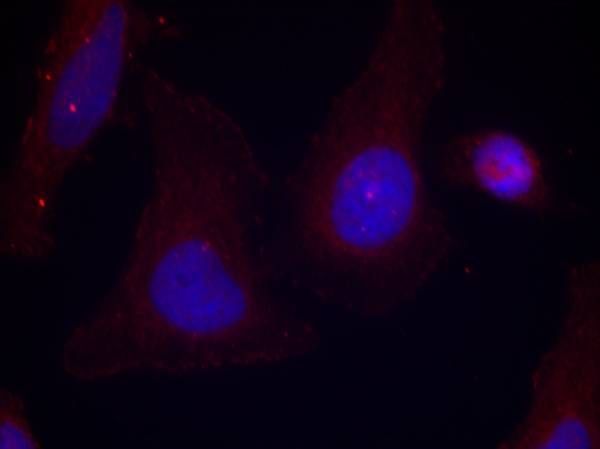 FAK (Phospho-Tyr397) Rabbit Polyclonal Antibody, 100 ug