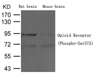 Opioid Receptor (Phospho-Ser375) Rabbit Polyclonal Antibody, 100 ug
