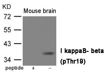 IkappaB- beta (Phospho-Thr19) Rabbit Polyclonal Antibody, 100 ug