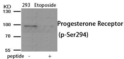 Progesterone Receptor (Phospho-Ser294) Rabbit Polyclonal Antibody, 100 ug