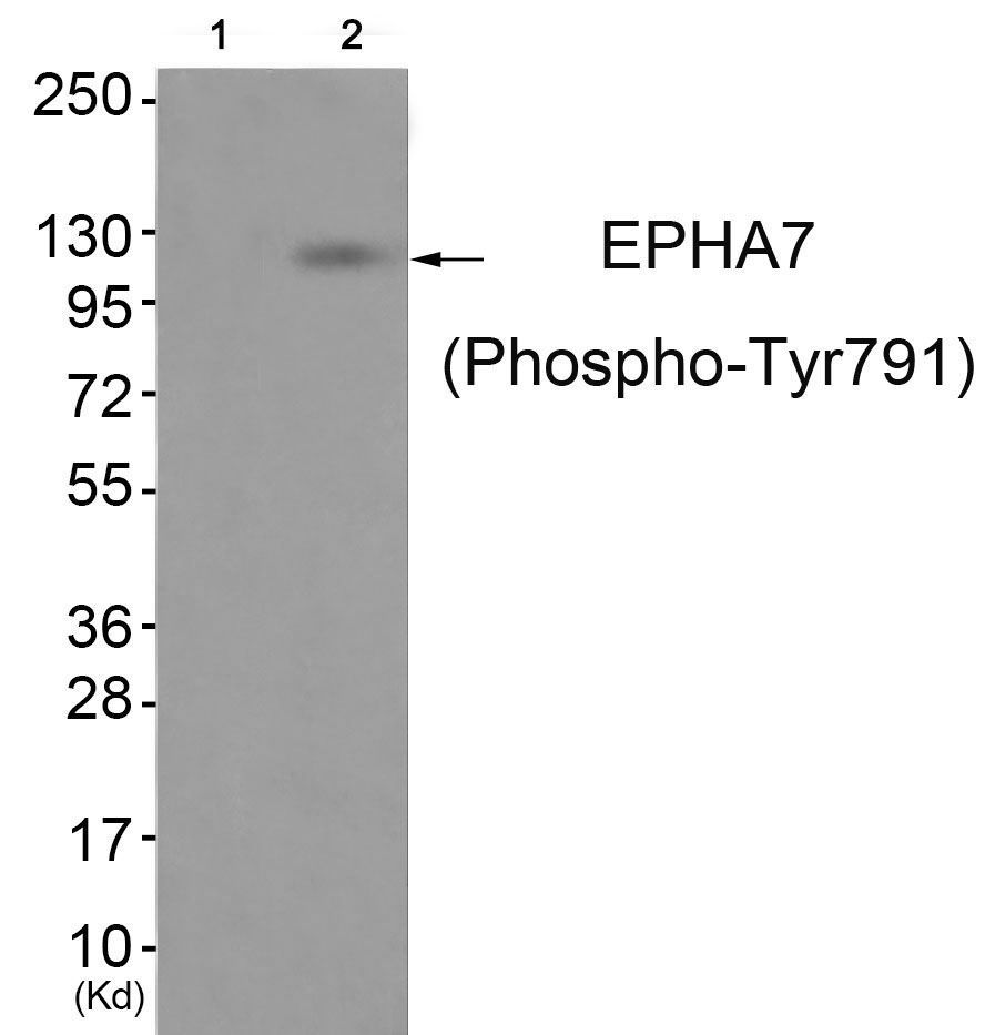 EPHA7 (Phospho-Tyr791) Rabbit Polyclonal Antibody, 100 ug
