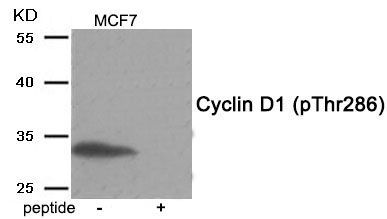 Cyclin D1 (Phospho-Thr286) Rabbit Polyclonal Antibody, 100 ug