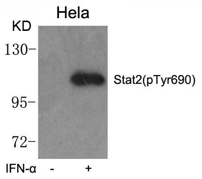 Stat2 (phospho-Tyr690) Rabbit Polyclonal Antibody, 100 ug