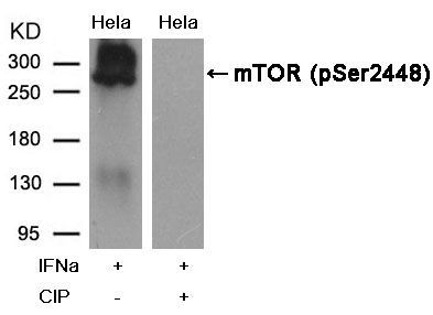 mTOR (Phospho-Ser2448) Rabbit Polyclonal Antibody, 100 ug