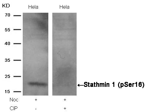 Stathmin 1 (Phospho-Ser16) Rabbit Polyclonal Antibody, 100 ug