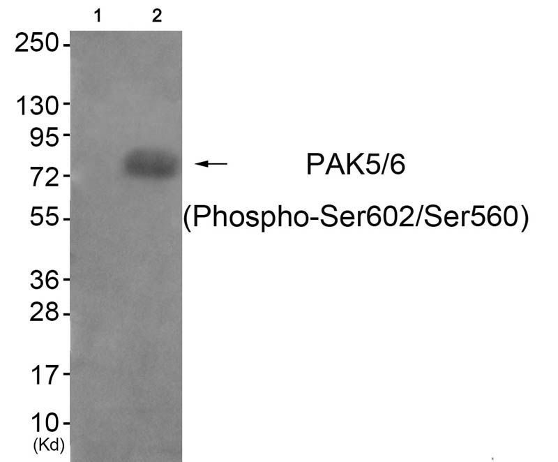 PAK5/6 (Phospho-Ser602/Ser560) Rabbit Polyclonal Antibody, 100 ug