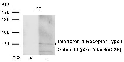 Interferon-a Receptor Type I Subunit I (phospho-Ser535/Ser539) Rabbit Polyclonal Antibody, 100 ug