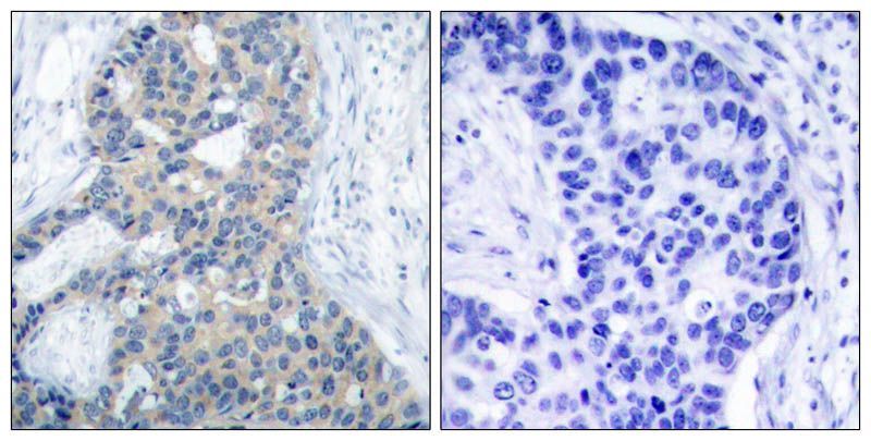 Stathmin 1 (Phospho-Ser38) Rabbit Polyclonal Antibody, 100 ug