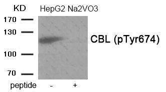 CBL (Phospho-Tyr674) Rabbit Polyclonal Antibody, 100 ug