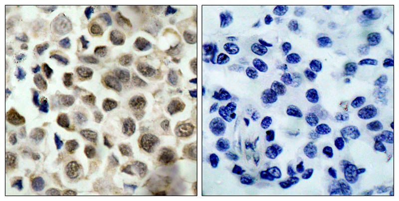 HDAC8 (Phospho-Ser39) Rabbit Polyclonal Antibody, 100 ug
