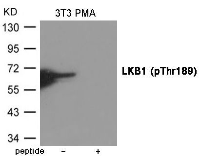 LKB1 (Phospho-Thr189) Rabbit Polyclonal Antibody, 100 ug