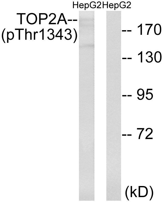 TOP2A (Phospho-Thr1343) Rabbit Polyclonal Antibody, 100 ug