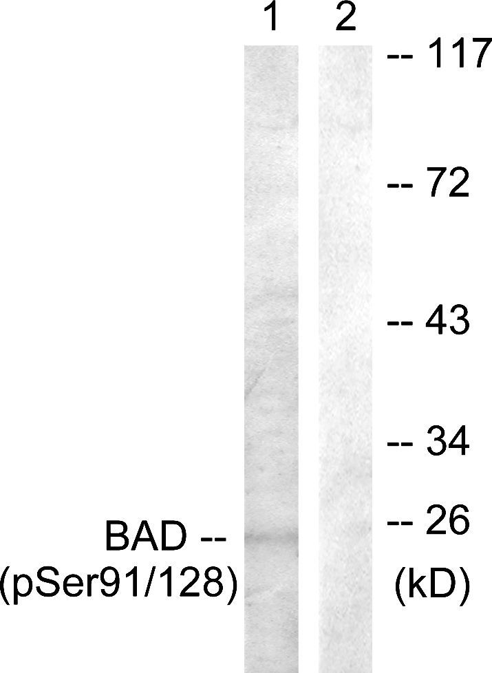 BAD (Phospho-Ser91/128) Rabbit Polyclonal Antibody, 100 ug