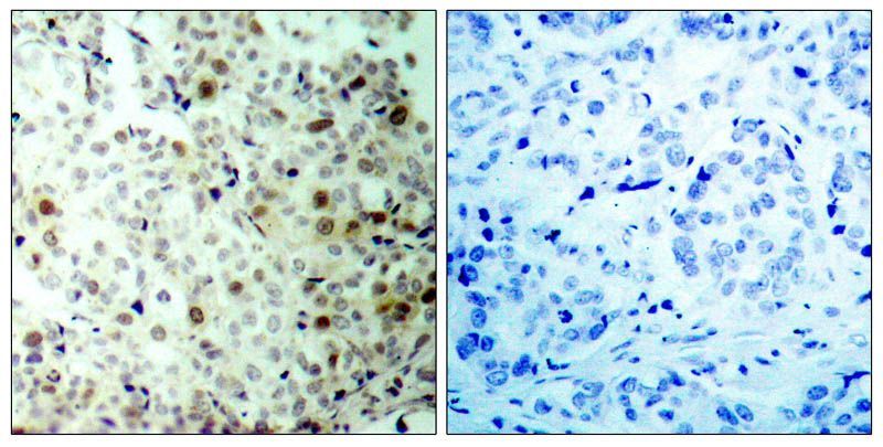 CDK2 (Phospho-Thr160) Rabbit Polyclonal Antibody, 100 ug