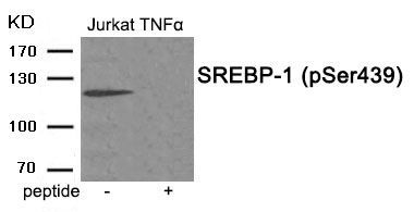 SREBP-1 (Phospho-Ser439) Rabbit Polyclonal Antibody, 100 ug