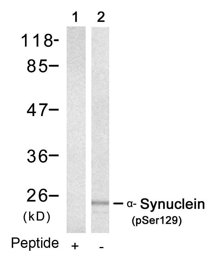 α-Synuclein (Phospho-Ser129) Rabbit Polyclonal Antibody, 100 ug