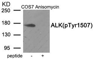 ALK (Phospho-Tyr1507) Rabbit Polyclonal Antibody, 100 ug