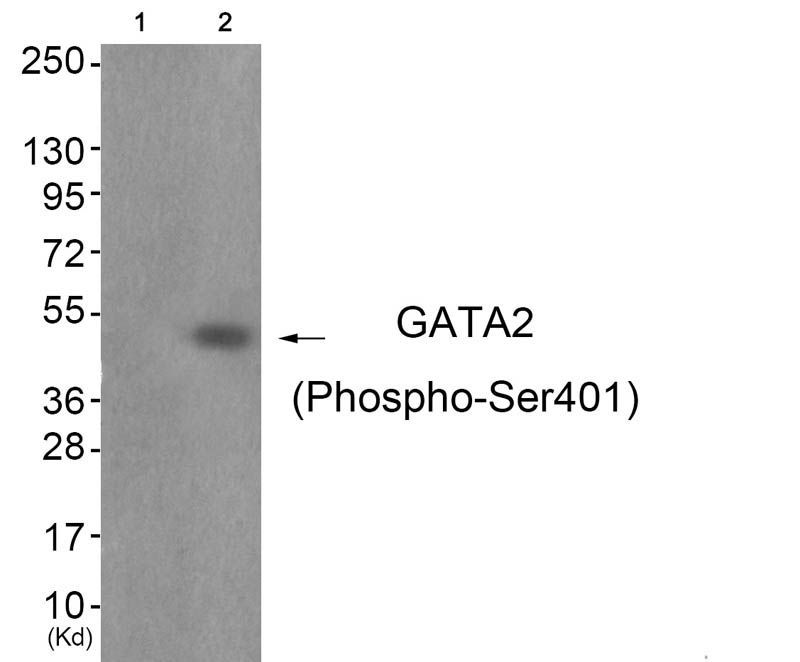 GATA2 (Phospho-Ser401) Rabbit Polyclonal Antibody, 100 ug